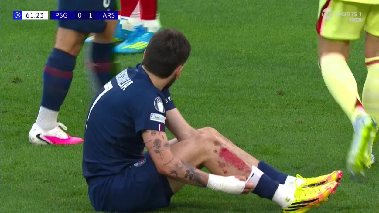 Khvicha Kvaratskhelia shows off a nasty looking leg wound